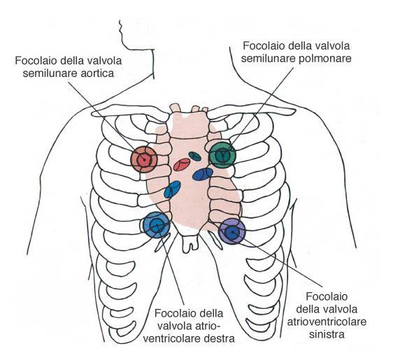 rumori cardiaci auscultazione del cuore 1 tono: chiusura scatto valvole A-V