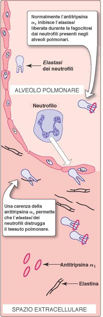 L antitripsina α (α1 ΑΤ), (prodotta dal fegato, e da monociti e macrofagi alveolari) impedisce la degradazione dell elastina nelle pareti alveolari.