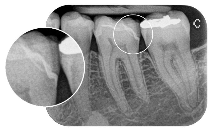 p.20 Eccellente qualità d'immagine Immagini ad alta risoluzione, assicurano diagnosi affidabili Risoluzione reale fino a 17 lp/mm Nuova