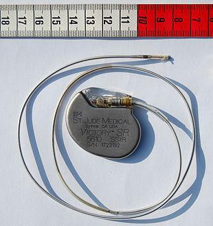 Il pacemaker artificiale Rappresenta un dispositivo elettronico che: agisce da stimolatore