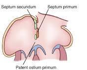 HF: atrio destro VF: atrio sinistro Il Forame di Botallo permette al sangue ossigenato, proveniente dalla placenta, di portarsi dall atrio destro al sinistro bypassando i polmoni ancora in sviluppo.