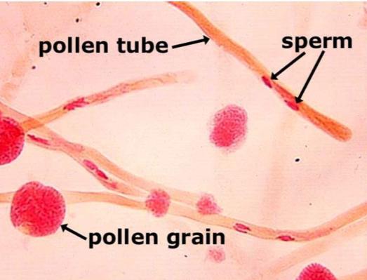 e la microgametogenesi Nelle gimnosperme