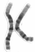 La genetica del gruppo Rh Per quanto riguarda il fattore Rh, gli alleli sono due: D (dominante e responsabile dell'rh+) d (recessivo) col loro locus genico individuato nel