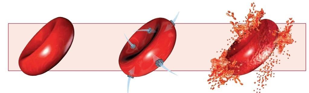 Le reazioni emolitiche Agglomerati e frammenti di eritrociti possono formare ammassi in grado di otturare vasi a livello polmonare cardiaco, renale e