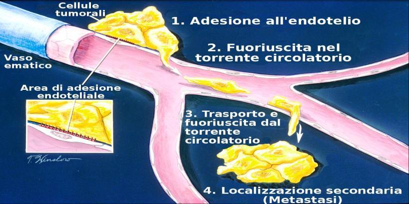 tumori delle cellule germinali Germinoma Carcinoma embrionale Tumore del sacco vitellino Coriocarcinoma Teratoma Maturo Immaturo Con trasf. maligna Tum. germ. a cell.