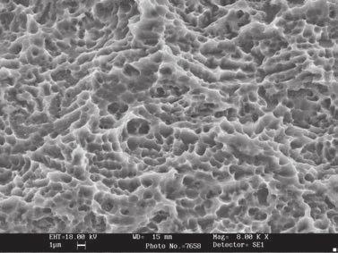 Il trattamento Sandblasted Largegrid and Acidetched, ottenuto mediante sabbiatura con corindone bianco e successiva mordenzatura con passaggi in diversi acidi, favorisce il processo di