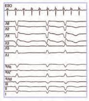 numerose frequenze di taglio selezionabili. La compattezza e la semplicità d uso dell apparecchio ne indicano inoltre il possibile impiego nelle registrazioni Holter.