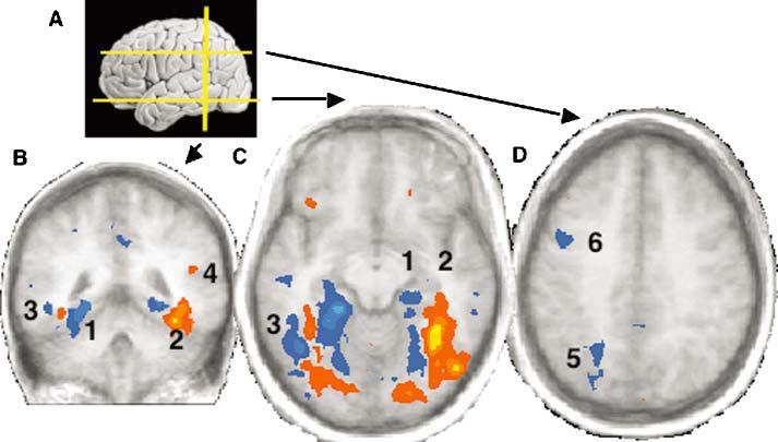 Neuroimaging funzionale della«embodied cognition» Arancio: maggiore attività durante il