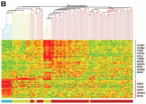 immunofenotipo diverso, diverso stato mutazionale delle IgVH (~( ~ 98% LPL cases