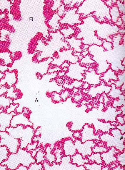 COMPONENTE RESPIRATORIA Gli alveoli derivano dai bronchioli