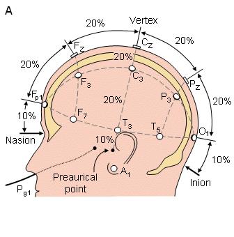 19/21 elettrodi (256 nel caso di high density EEG) tipo Ag/AgCl (diametro < 3mm) Posizionamento secondo il modello 10-20 raccomandato dalla IFCN