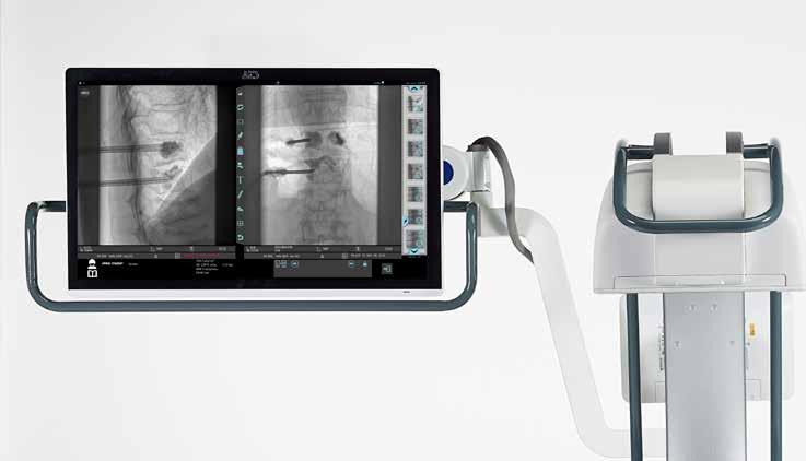 Monitor orientabile in altezza ed angolazione con ampia estensione laterale del braccio articolato.