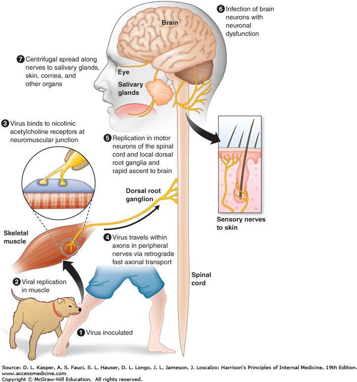 PATOGENESI Trasmissione dell infezione mediante: morso di animale infetto (più frequente) trapianto di tessuti infetti (cornea, in particolare) inalazione di aerosols (grotte dove risiedono