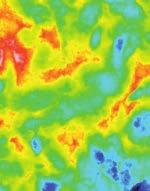 Il tessuto osseo preesistente viene ottimamente sfruttato grazie al design dell impianto e al protocollo chirurgico orientato