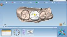 odontoiatrico CAD/CAM per