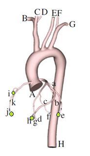 Il circuito (2) Il circuito verrà collegato ad ogni singola arteria coronaria (condizioni al bordo). Prendendo in esame un gruppo di arterie coronarie (per es.