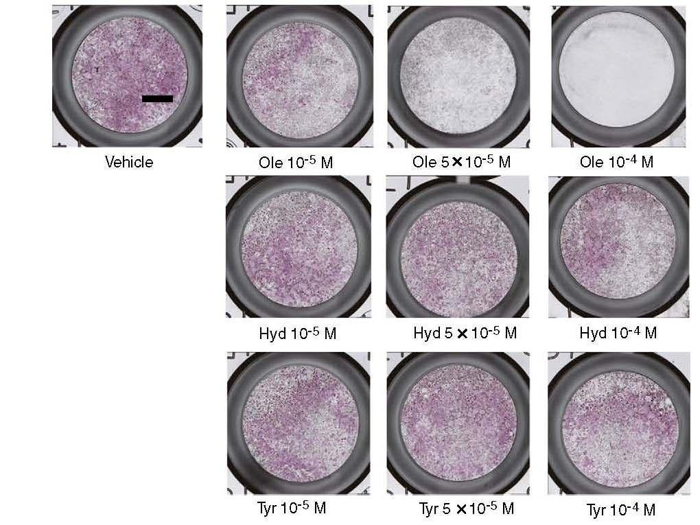 INIBIZIONE DELLA FORMAZIONE DI OSTEOCLASTI DA PARTE DEI POLIFENOLI DI OLIVA Effetti dei polifenoli di oliva sulla formazione degli osteoclasti.