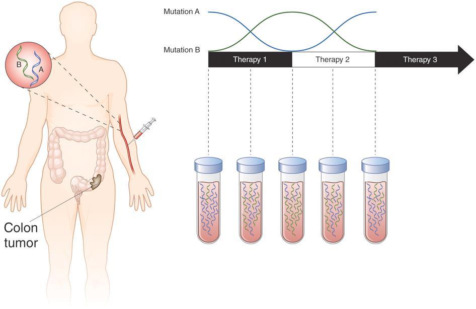 Monitorare la risposta alla terapia mediante biopsia