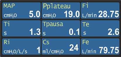 5.12.3 Monitoraggio parametri AGGIUNTIVI Questo tipo di configurazione grafica è attiva nell area H ed è utilizzata per il monitoraggio di altri parametri ventilatori (per la procedura di