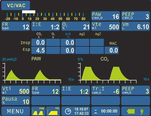 Monitoraggio parametri Premere il tasto AUT: l unità di anestesia inizia a ventilare.