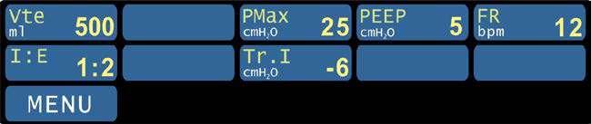 7.5 Parametri respiratori fisiologici [ PRF ] In figura i parametri visualizzati sono riferiti alla modalità operativa APCV-TV e hanno uno scopo puramente esemplificativo e non fanno riferimento a