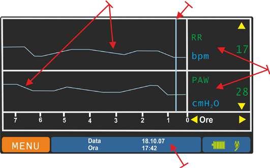 La visualizzazione TRENDS include: una segnalazione a tratto/barra verticale che indica lo spostamento temporale i grafici, visualizzati a coppie i parametri, selezionabili a coppie tramite manopola