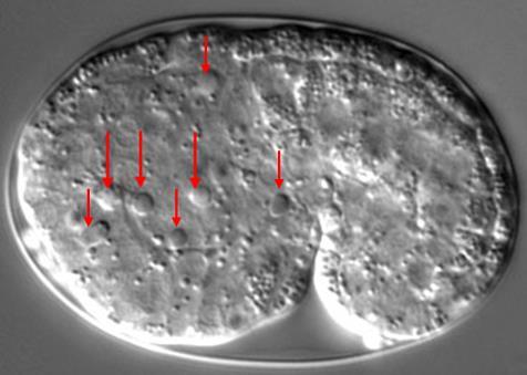 Apoptosis in C.