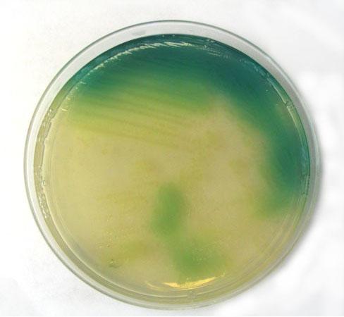 Tra$amento antecedente con più classi di an<bio<ci 1. Fibrosi cis<ca 2.