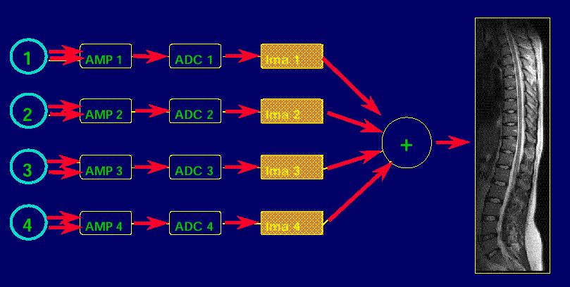 Lo sviluppo delle bobine phased-array con ricevitori multipli permette di acquisire volumi grandi (ad