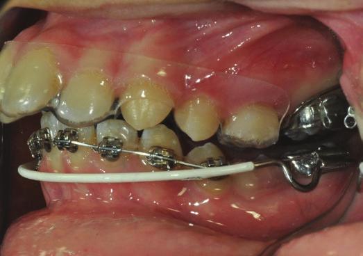 (06-07 NOVEMBRE 2015) Basi della Tecnica Bidimensionale: la razionalità Principi di biomeccanica: la