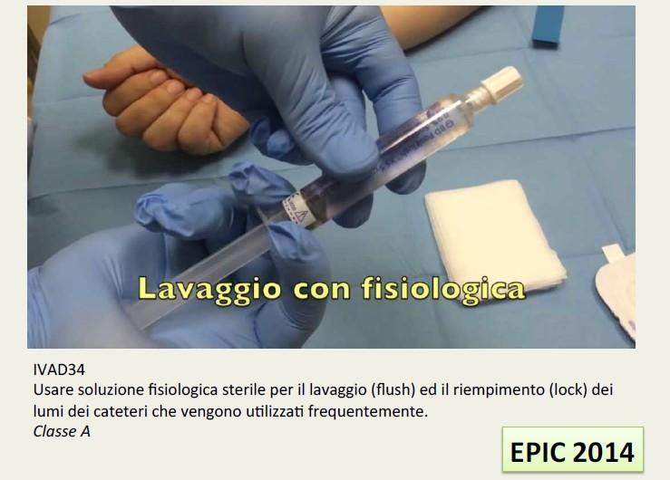 LAVAGGIO E CHIUSURA DEL SISTEMA Uno studio, pubblicato sul Journal of Hospital Infection ha dimostrato che, grazie all