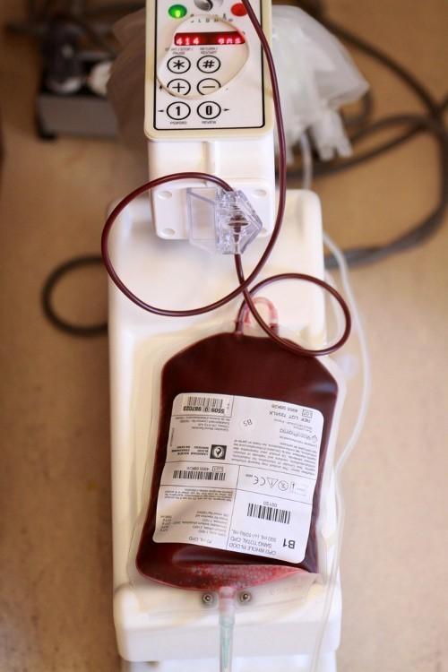 LINEE DI INFUSIONE Quando si infonde una emotrasfusione, filtri e set di somministrazione vanno sostituiti al termine di ogni unità di sangue o comunque ogni 4 ore INS-2016 Sostituire i set usati per