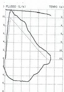 PARTENZA ESPLOSIVA LA CURVA F/V DEVE CRESCERE IN MODO RAPIDO