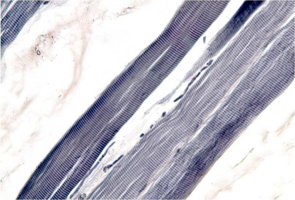 Muscolo (endomisio) Fasci di fibre muscolari (perimisio) Fibre muscolari (endomisio) Miofibrille Miofilamenti Elementi contrattili che decorrono