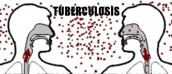 TUBERCOLOSI E SALUTE PUBBLICA Persone con TB attiva possono diffondere ad altri la malattia.