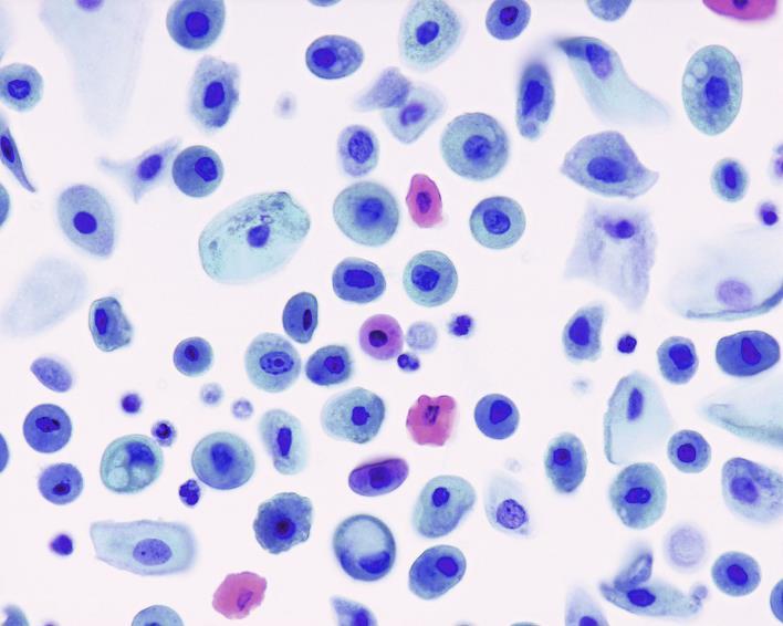 LBC Le cellule presenti sul vetrino sono numericamente minori