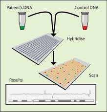 Anomalie identificate con il CGH-array L ibridazione genomica comparativa (CGH-array) è una tecnica sviluppata per identificare amplificazioni-duplicazioni (gain) e/o di perdite-delezioni (loss) di