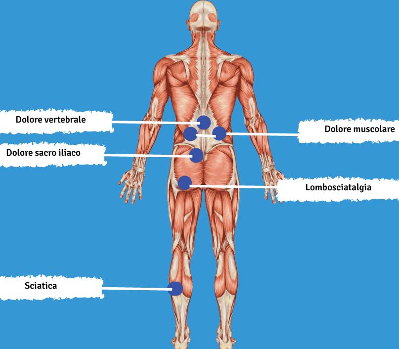 Lombalgia sinonimo di«mal di schiena».