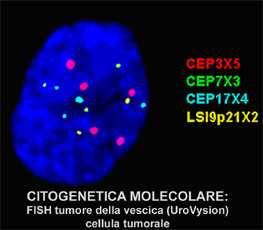 Pagina 79 di 81 Metodiche avanzate in citologia CITOLOGIA URINARIA E il metodo di riferimento più avanzato e riconosciuto in campo internazionale.