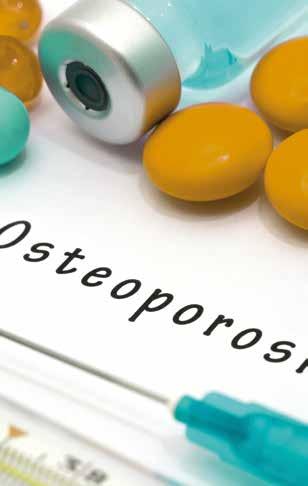 OSTEOPOROSI IL RUOLO DEI FARMACI L osteoporosi è una condizione da cui non si guarisce: i farmaci disponibili non la curano, consentono semplicemente di rallentarne o arrestarne la progressione.