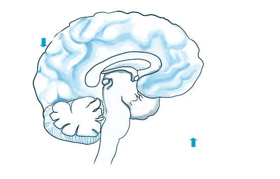 Che cosa è l ansia: basi biologiche e correlazioni cliniche SSRI < 5HT compulsioni > stereotipie comportamentali caudato urgenza irresistibilità gyrus cinguli amigdala cortex gyrus orbitale >