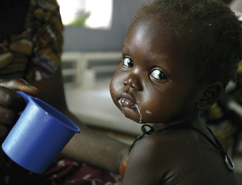 La malnutrizione dei bambini L impegno