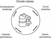 53. La riabilitazione del paziente affetto da scoliosi idiopatica 2791 scoliosi, in cui non è tanto la postura a determinare un peggioramento della patologia, quanto le alterazioni della meccanica