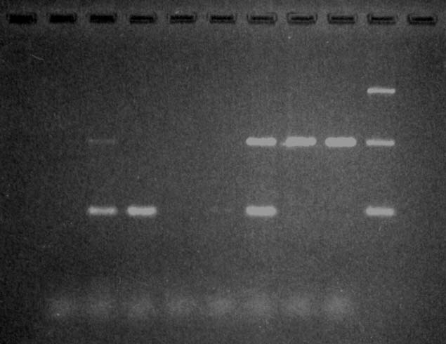 PCR Limite di rilevabilità: 10-100 u.f.c.