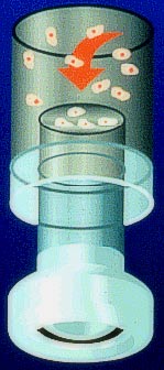 soluzione Preservcyt invece facilita il trasferimento ed il fissaggio delle cellule sul Thin Prep Microscope Slide conservando il preparato per più di 3 settimane.