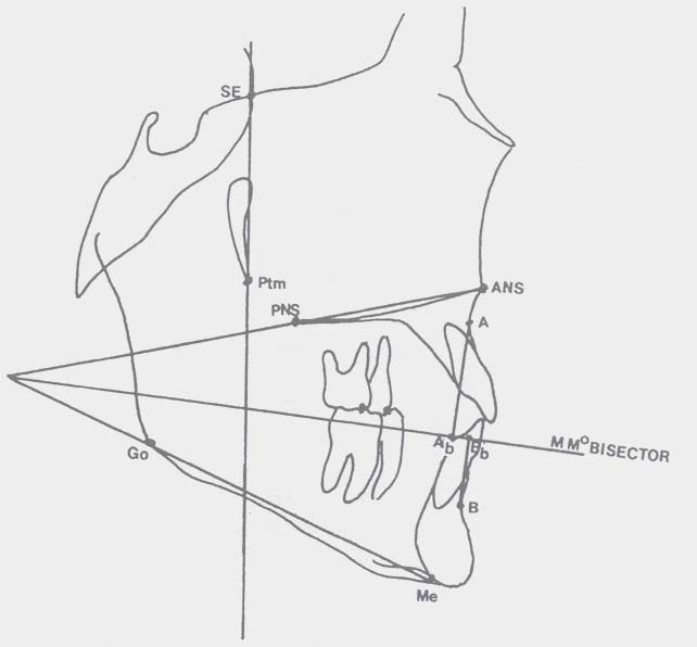 Il fatto che l occlusione non sia una piano, ma una curva (21, 31), lo sdoppiamento delle immagini destra e sinistra, le asimmetrie facciali, la presenza dei terzi molari, la malposizione dentale o l