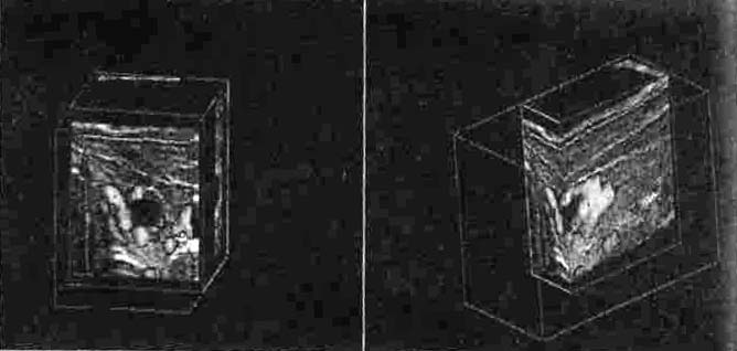 laser, a microonde e con l ausilio di ultrasuono ad alta intensità, e anche criocoagulazione dei focolai patologici.