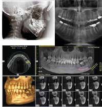 Cosciente Endovenosa (Padova) Membro SIO (Società Italiana Implantologia Osteointegrata) Dr.