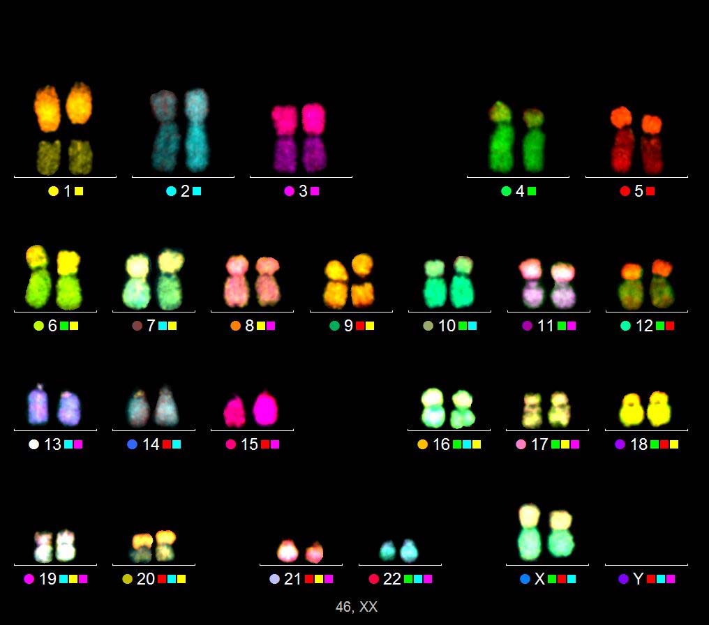 Fig. 60: Cariotipo normale di un linfocita umano visualizzato con la tecnica arm mfish Le braccia p dei cromosomi meta e submetacentrici possiedono un marcatore fluorescente addizionale, necessario
