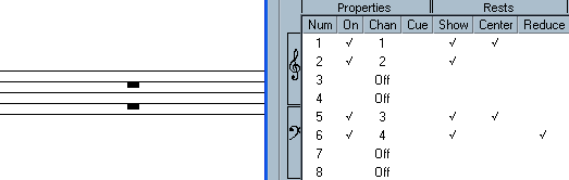 Nell esempio seguente viene visualizzata solamente la pausa della voce 1 e non quella della voce 2.